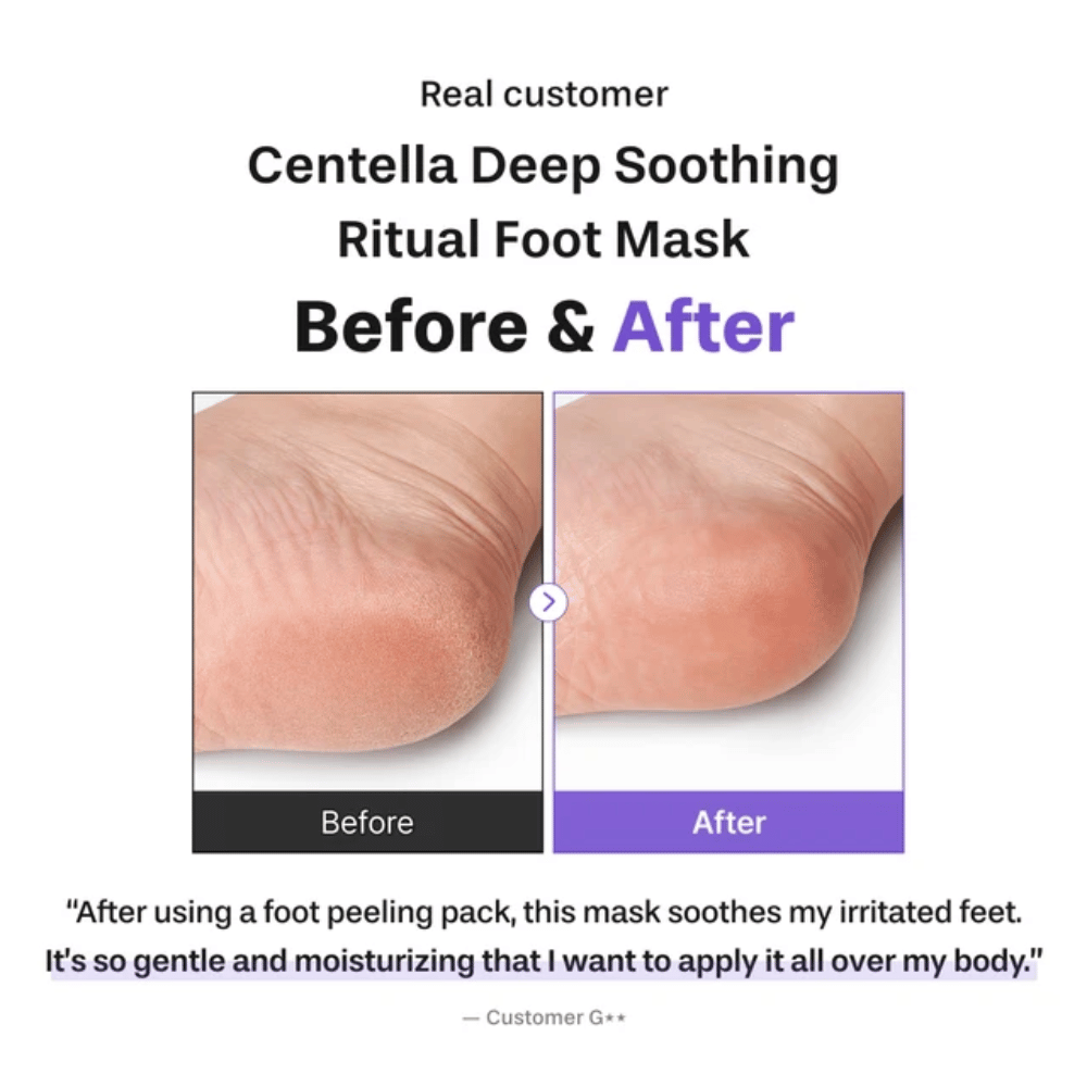6. Baren Centella Deep Soothing Ritual Foot Mask – før- og efterbillede, der viser en blødere og mere fugtet hæl efter brug