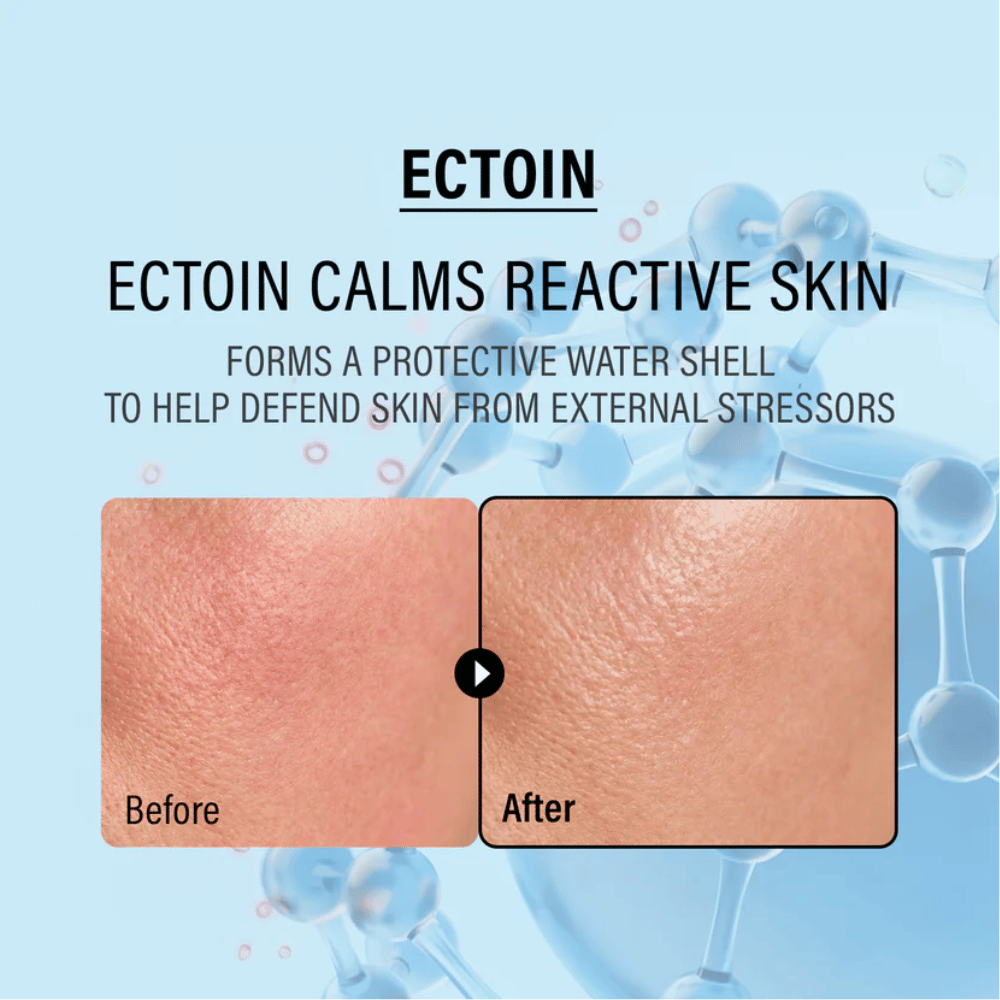 EPII Double Up Cream med ectoin, som beroliger sensitiv hud, beskytter mod ydre påvirkninger og styrker hudens naturlige barriere.
