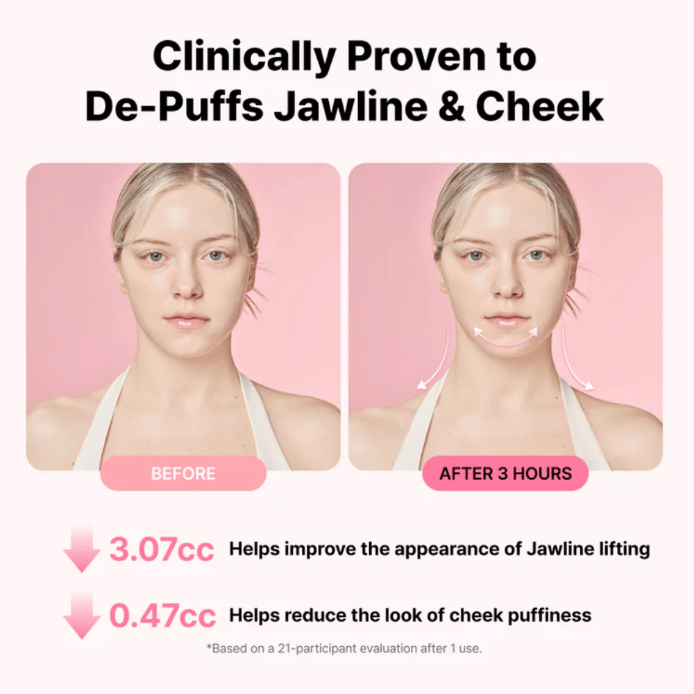 Før- og efterbillede, der illustrerer forbedret udseende af kæbelinjen og reduceret hævelse efter brug af RETURNITY Ear Therapy Acupressure Patch i tre timer.