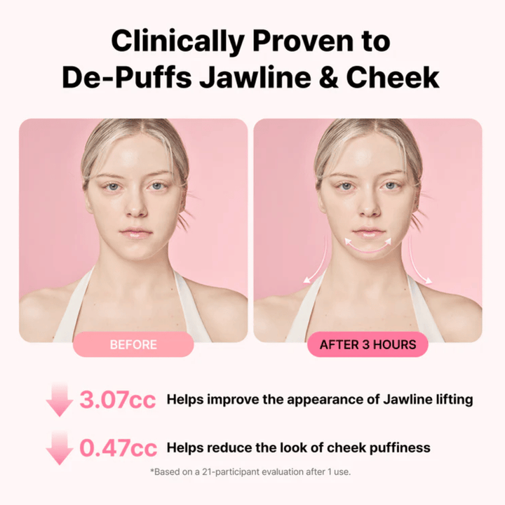 Før- og efterbillede, der illustrerer forbedret udseende af kæbelinjen og reduceret hævelse efter brug af RETURNITY Ear Therapy Acupressure Patch i tre timer.