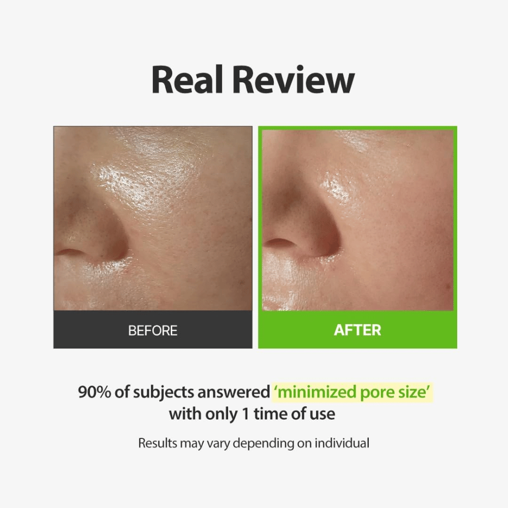SUNGBOON EDITOR Green Tomato Pore Peeling Jumbo Pad – før- og efterbillede med fokus på synlige porer