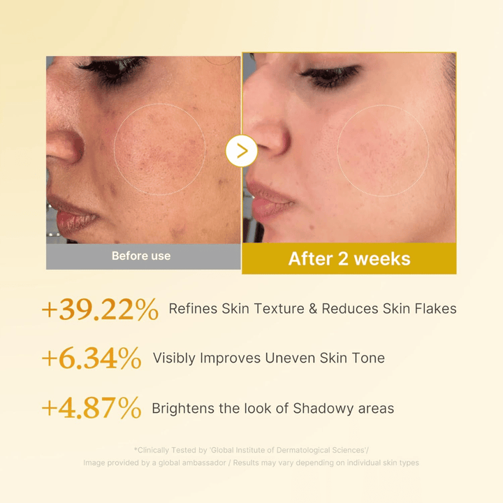 Før- og efterbillede for Medicube Kojic Acid Turmeric Resurfacing Toner som viser forbedret hudtekstur, mere jævn hudtone og reducerede tørre hudflager efter to ugers brug.