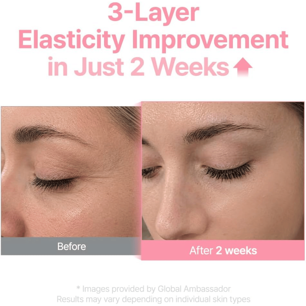 Før- og efterbillede for Purito Multi PDRN Collagen EGF Serum som viser forbedret hudelasticitet efter to uger.