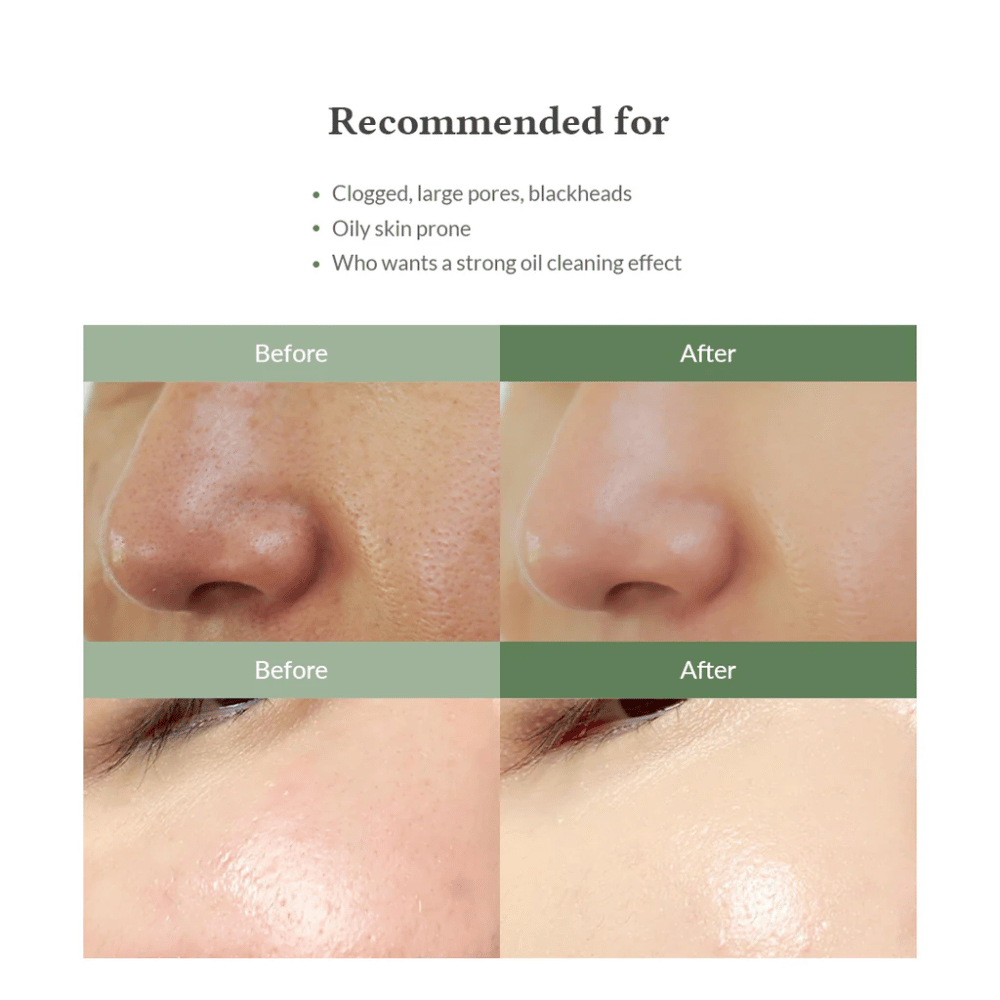 Dr. Althea Premium Quick Step Sebum Cleanser – ansigtsrens, der hjælper med at reducere hudorme, rense porer i dybden og give en jævnere hudstruktur.