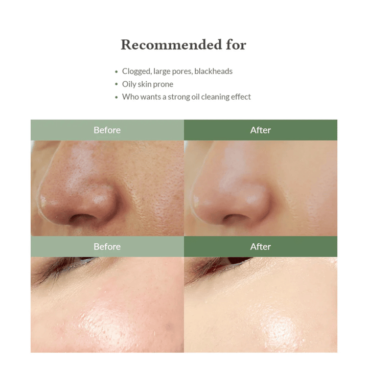 Dr. Althea Premium Quick Step Sebum Cleanser – ansigtsrens, der hjælper med at reducere hudorme, rense porer i dybden og give en jævnere hudstruktur.